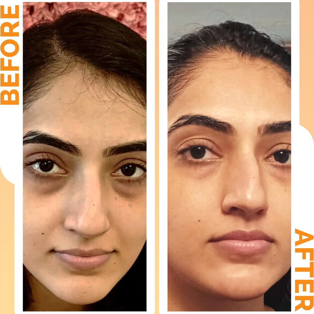 24K Gold Energy Beauty Bar Electric Facial Massage Roller